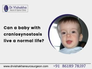 Read more about the article Can a baby with craniosynostosis live a normal life?