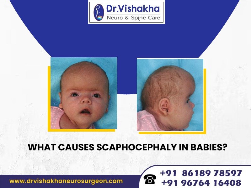 Read more about the article What causes scaphocephaly in babies?