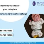 How do you know if your baby has Craniosynostosis/ Scaphocephaly? Dr Vishakha Paediatric neurosurgeon