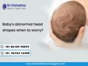 Read more about the article  Baby’s abnormal head shapes when to worry?