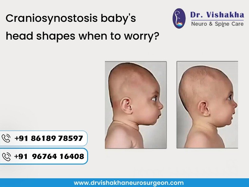 You are currently viewing Baby’s abnormal head shapes when to worry?