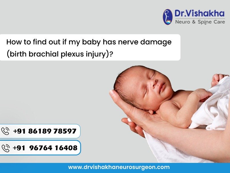 Read more about the article How to find out if my baby has nerve damage (birth brachial plexus injury)?