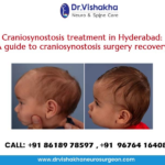 Craniosynostosis treatment in Hyderabad: A guide to craniosynostosis surgery recovery