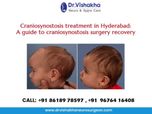 Read more about the article Craniosynostosis treatment in Hyderabad: A guide to craniosynostosis surgery recovery