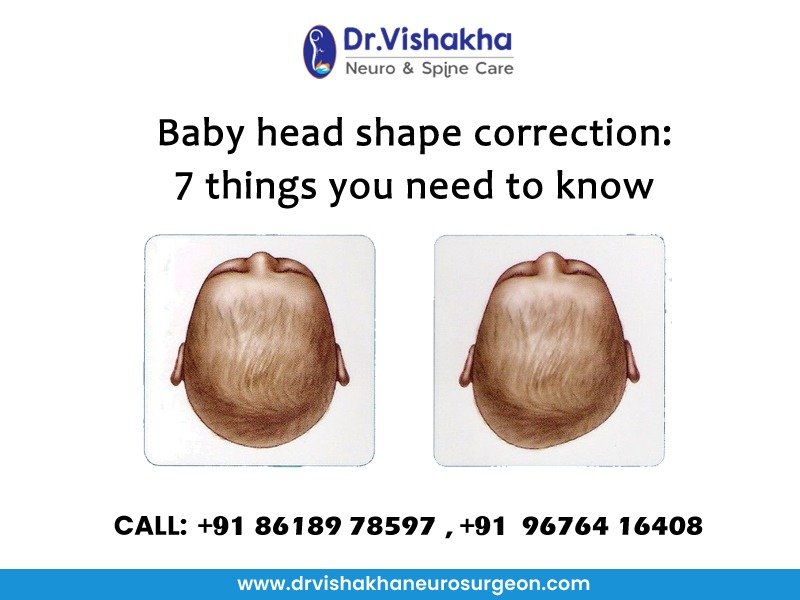 Read more about the article Baby Head Shape Correction: 7 Things You Need to Know