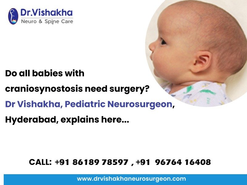 You are currently viewing Do All Babies with Craniosynostosis Need Surgery? Dr. Vishakha, the best Pediatric Neurosurgeon, Hyderabad, explains here