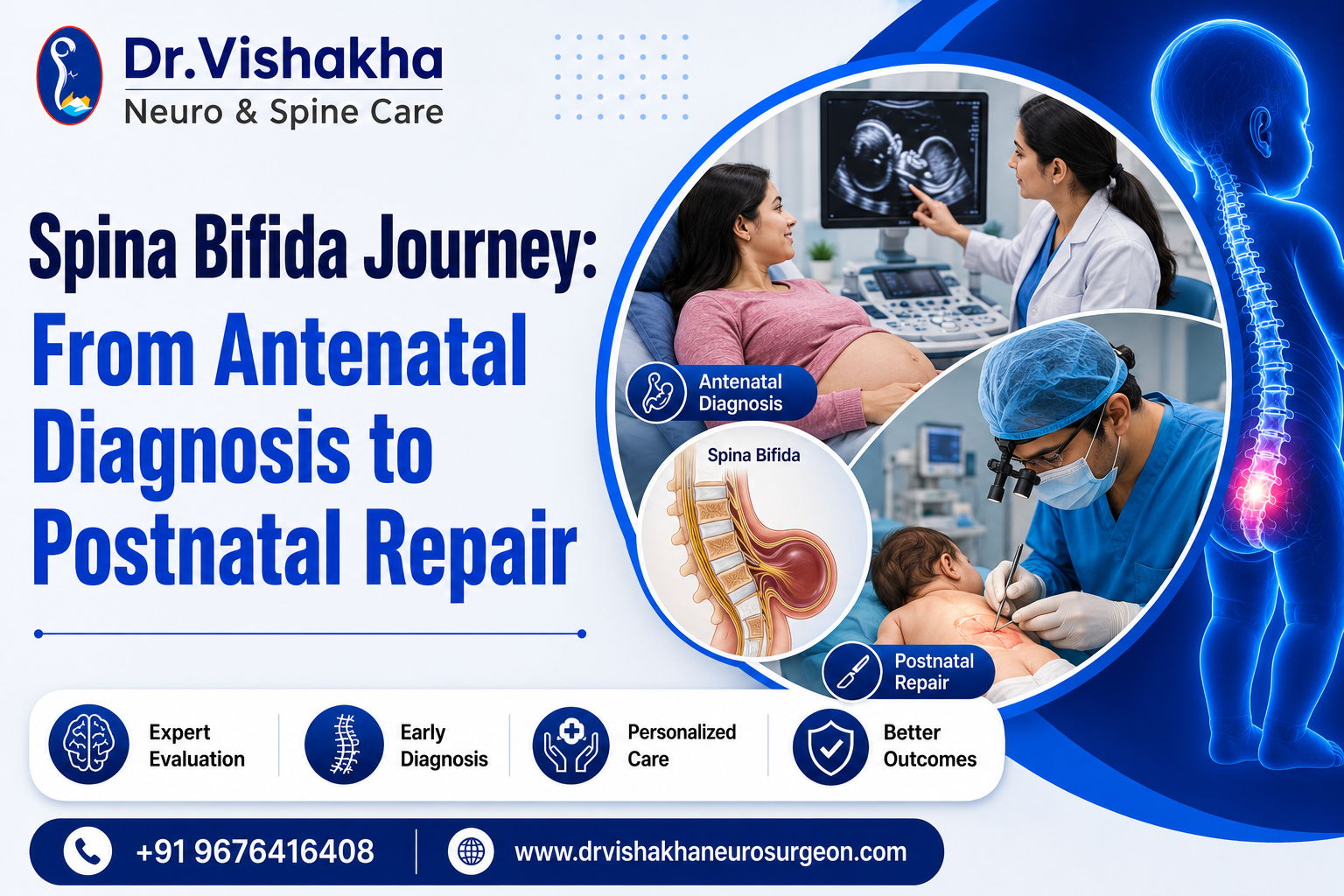 You are currently viewing Spina Bifida Journey: From Antenatal Diagnosis to Postnatal Repair