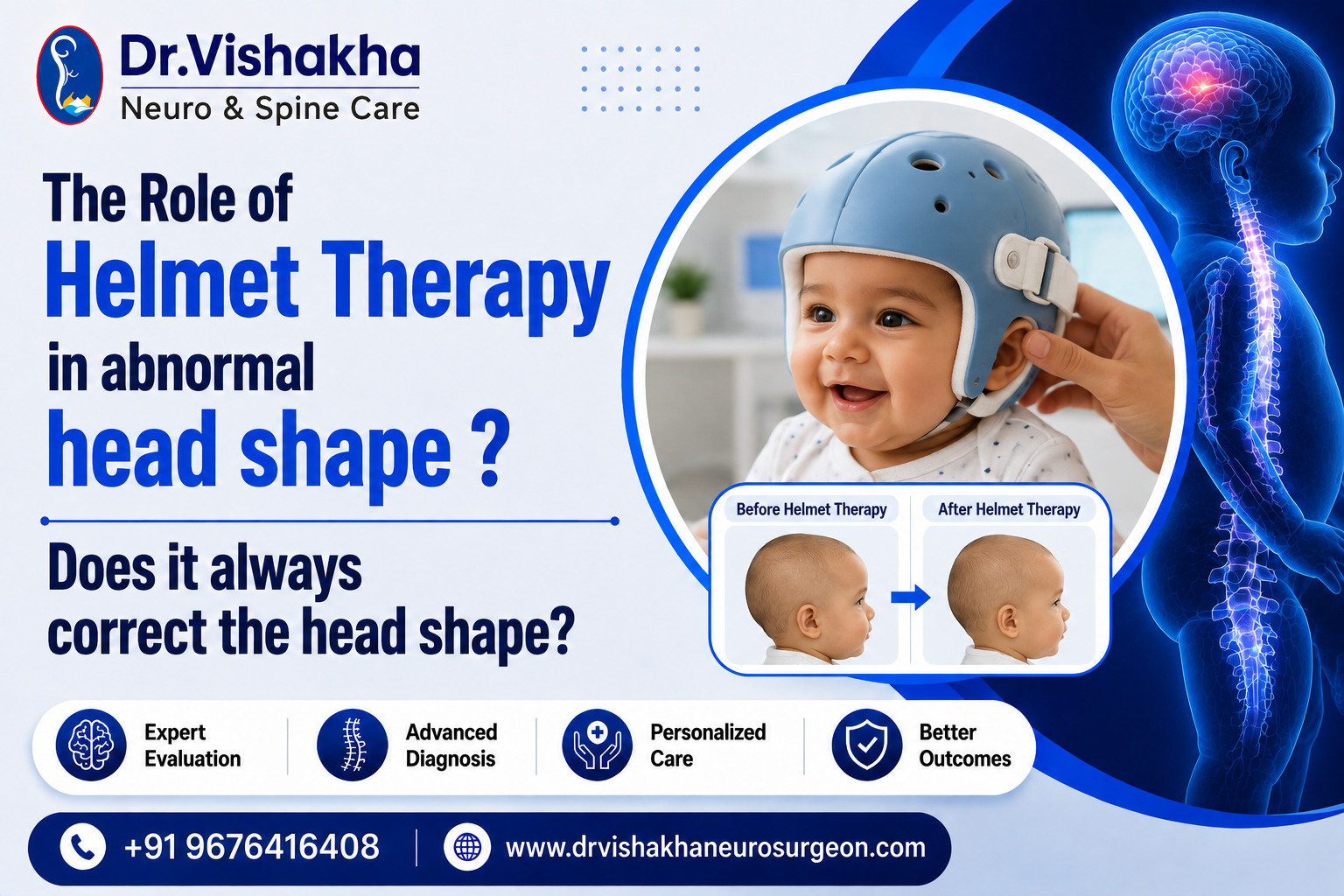 You are currently viewing The Role of Helmet Therapy in abnormal head shape ? Does it always correct the head shape?