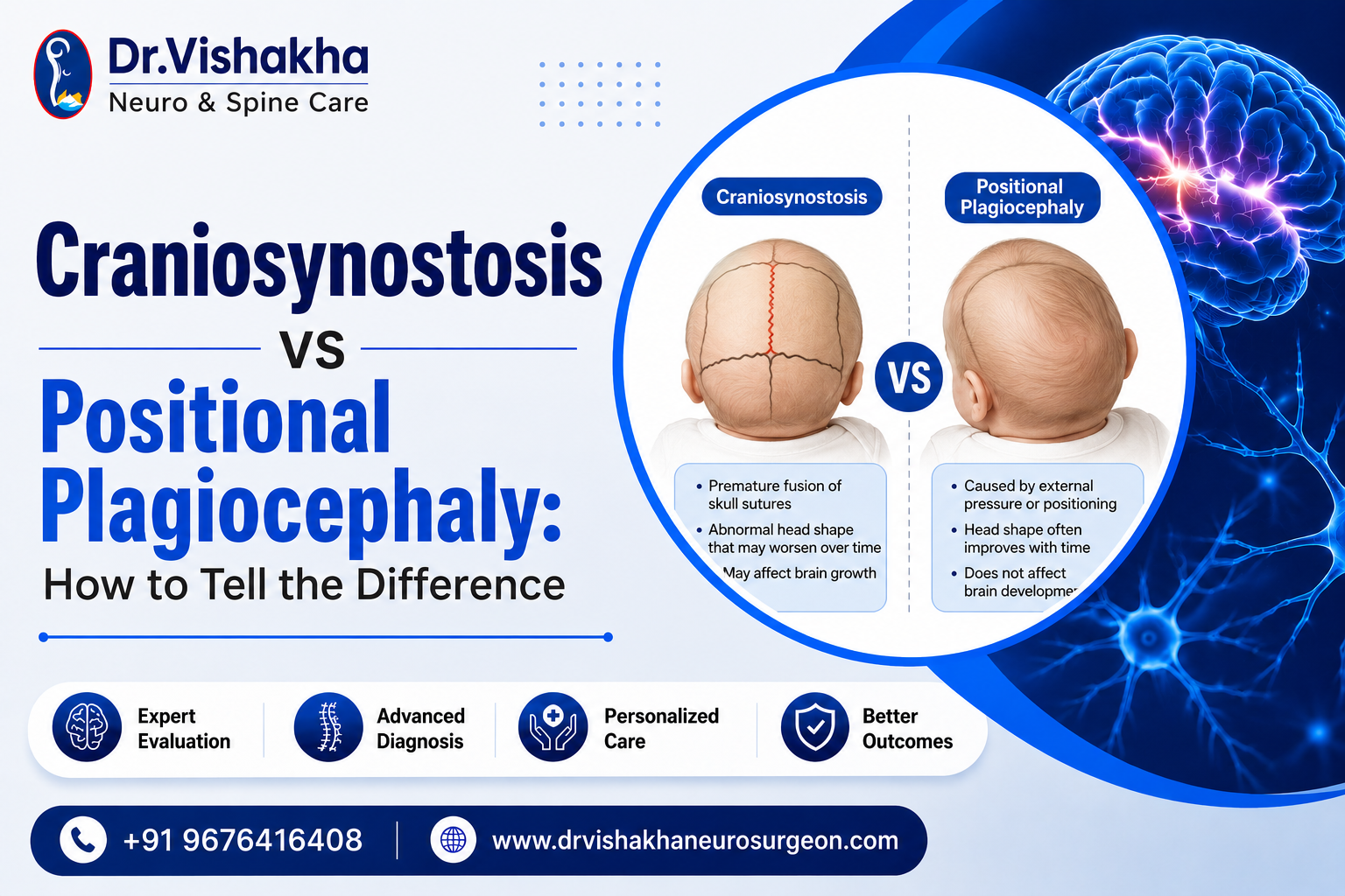 You are currently viewing Craniosynostosis vs Positional Plagiocephaly: How to Tell the Difference