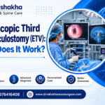 Endoscopic Third Ventriculostomy (ETV): How Does It Work?