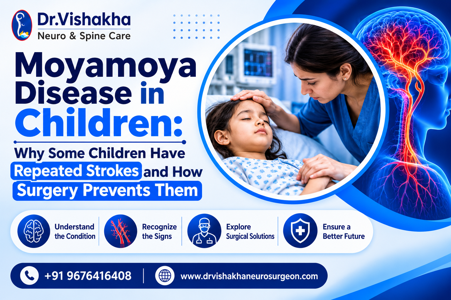You are currently viewing Moyamoya Disease in Children: Why Some Children Have Repeated Strokes and How Surgery Prevents Them