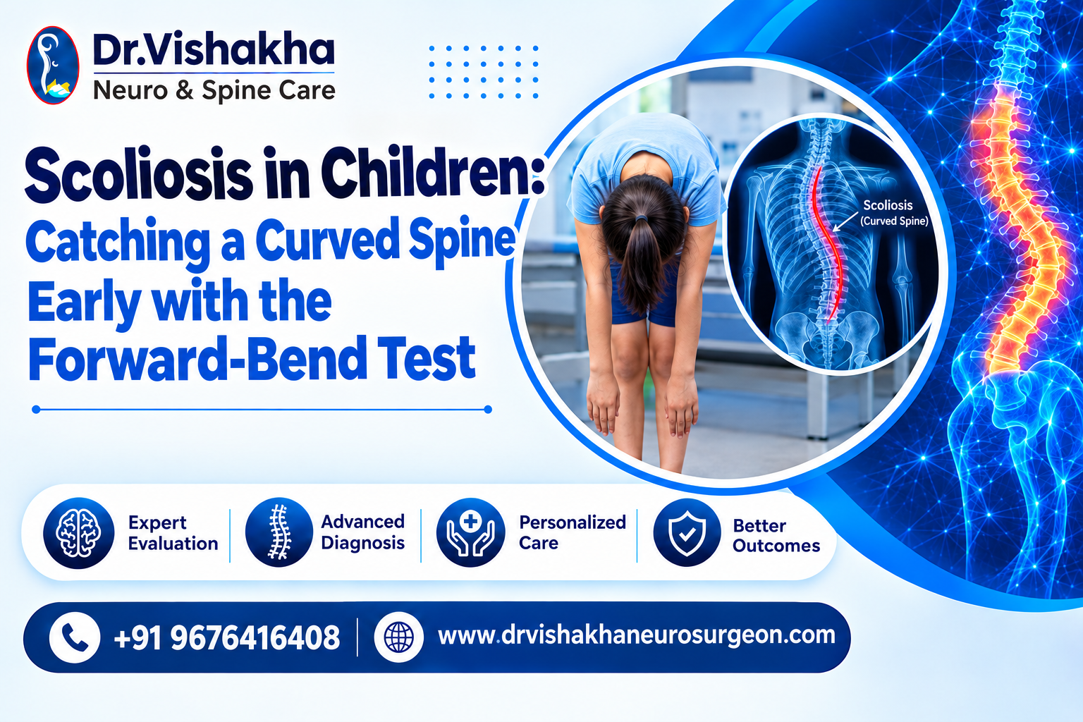 You are currently viewing Scoliosis in children: catching a curved spine early with the forward-bend test