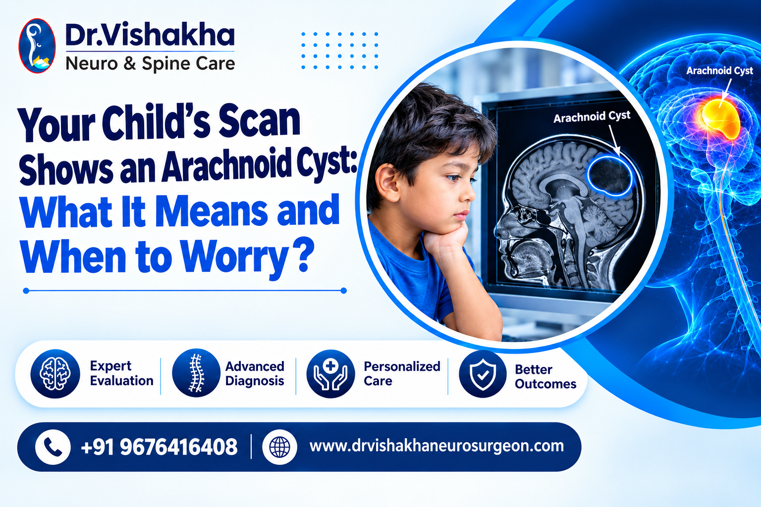 You are currently viewing Your child’s scan shows an arachnoid cyst: what it means and when to worry ?